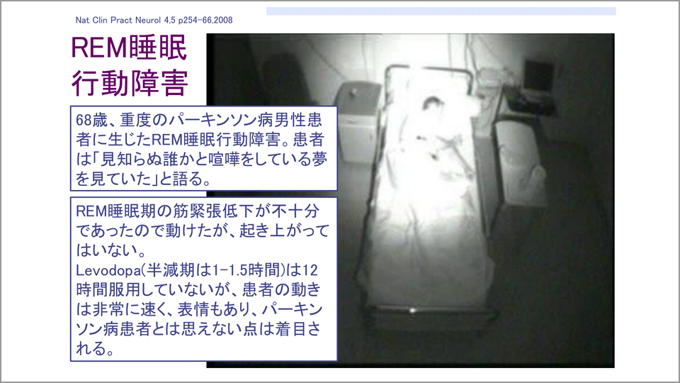 睡眠障害 うつ レビー小体型認知症の診断ポイント 尾崎紀夫 テンミニッツtv