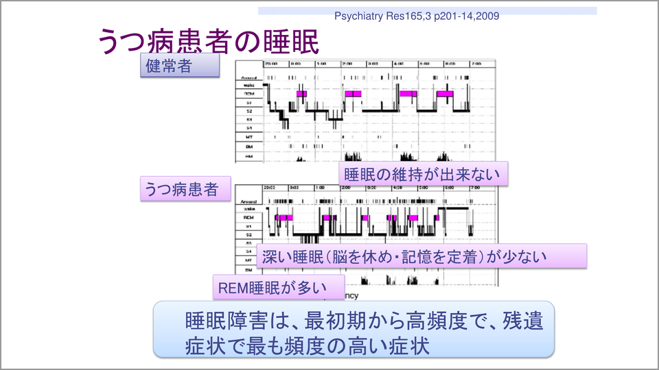 うつ病のものの捉え方が不眠を招く 尾崎紀夫 テンミニッツtv